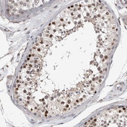 ACRC Antibody, Novus Biologicals:Antibodies:Primary Antibodies