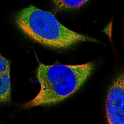 ACSBG2 Antibody, Novus Biologicals 25 &mu;L; Unlabeled:Antibodies, Polyclonal