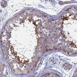 ACSBG2 Antibody, Novus Biologicals 25 &mu;L; Unlabeled:Antibodies, Polyclonal