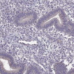 ACSBG2 Antibody, Novus Biologicals 25 &mu;L; Unlabeled:Antibodies, Polyclonal