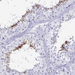 ACSBG2 Antibody, Novus Biologicals 25 &mu;L | Buy Online | Novus Biologicals | Fisher Scientific