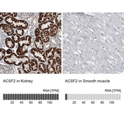 ACSF2 Antibody, Novus Biologicals:Antibodies:Primary Antibodies