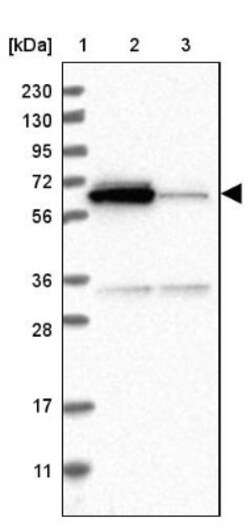 ACSF2 Antibody, Novus Biologicals:Antibodies:Primary Antibodies