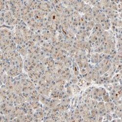 ACSL5 Antibody, Novus Biologicals:Antibodies:Primary Antibodies