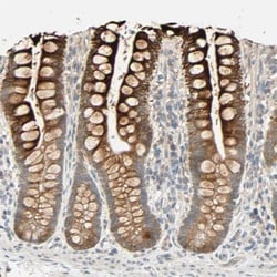 ACSL5 Antibody, Novus Biologicals:Antibodies:Primary Antibodies