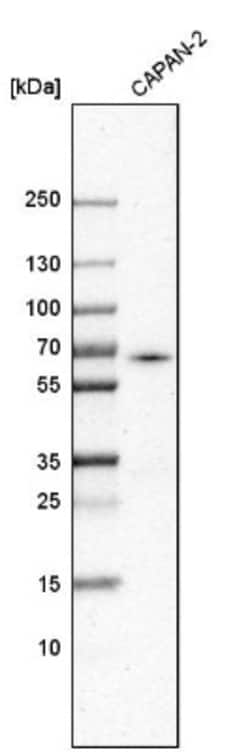 ACSL5 Antibody, Novus Biologicals:Antibodies:Primary Antibodies