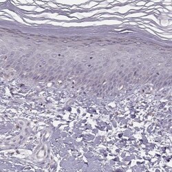 ACSL6 Antibody, Novus Biologicals 0.1mL; Unlabeled:Antibodies, Polyclonal