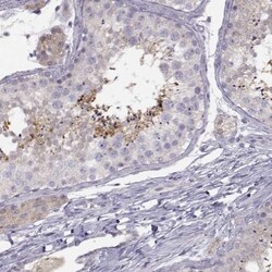ACSL6 Antibody, Novus Biologicals 0.1mL; Unlabeled:Antibodies, Polyclonal