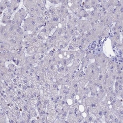 ACSS1 Antibody, Novus Biologicals:Antibodies:Primary Antibodies