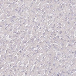 ACSS1 Antibody, Novus Biologicals 0.1mL; Unlabeled:Antibodies, Polyclonal