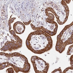 ACSS1 Antibody, Novus Biologicals 0.1mL; Unlabeled:Antibodies, Polyclonal