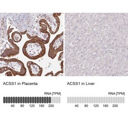 ACSS1 Antibody, Novus Biologicals 0.1mL; Unlabeled:Antibodies, Polyclonal