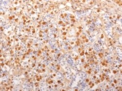 ACTH Antibody (2F6) - N-terminal, Novus Biologicals 0.1 mg, Unconjugated:Antibodies,