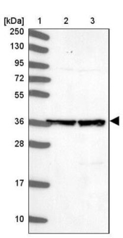 ACTL6B Antibody, Novus Biologicals 0.1mL; Unlabeled:Antibodies, Polyclonal