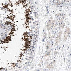 ACTL7A Antibody, Novus Biologicals 0.1mL; Unlabeled:Antibodies, Polyclonal