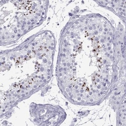 ACTL7A Antibody, Novus Biologicals 0.1mL; Unlabeled:Antibodies, Polyclonal