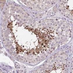 ACTRT2 Antibody, Novus Biologicals:Antibodies:Primary Antibodies