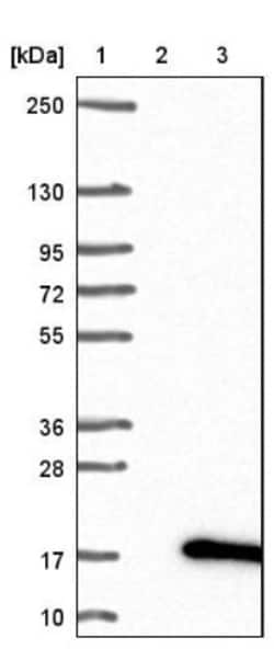 ACYP1 Antibody, Novus Biologicals 0.1mL; Unlabeled:Antibodies, Polyclonal