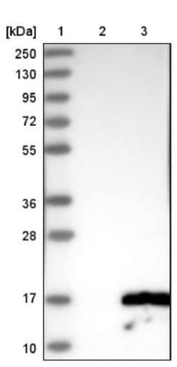 SLC22A16 Antibody, Novus Biologicals:Antibodies:Primary Antibodies