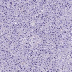 ADAM12 Antibody, Novus Biologicals 25 &mu;L | Buy Online | Novus Biologicals | Fisher Scientific