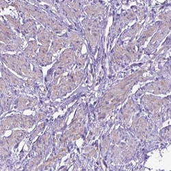 ADAM12 Antibody, Novus Biologicals:Antibodies:Primary Antibodies
