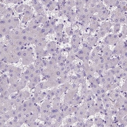ADAM12 Antibody, Novus Biologicals 0.1mL; Unlabeled:Antibodies, Polyclonal