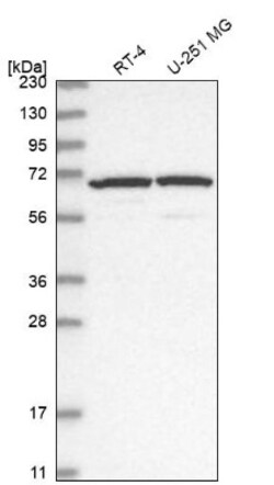 ADAM12 Antibody, Novus Biologicals 0.1mL; Unlabeled:Antibodies, Polyclonal