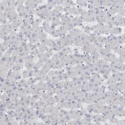 ADAM2 Antibody, Novus Biologicals:Antibodies:Primary Antibodies