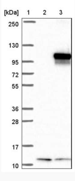 INTS6 Antibody, Novus Biologicals:Antibodies:Primary Antibodies