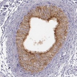 ADAM7 Antibody, Novus Biologicals 0.1mL; Unlabeled:Antibodies, Polyclonal