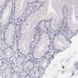 ADAM7 Antibody, Novus Biologicals 0.1mL; Unlabeled:Antibodies, Polyclonal