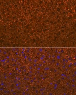 ADAMTS13 Rabbit anti-Human, Mouse, Rat, Clone: 7B2Z8, Novus Biologicals