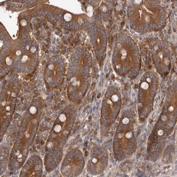 ADAMTS20 Antibody, Novus Biologicals:Antibodies:Primary Antibodies