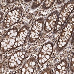 ADAMTS20 Antibody, Novus Biologicals:Antibodies:Primary Antibodies