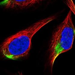 ADAMTS3 Antibody, Novus Biologicals 0.1mL; Unlabeled:Antibodies, Polyclonal