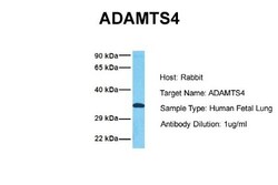 ADAMTS4 Antibody, Novus Biologicals 0.05mg; Unlabeled:Antibodies, Polyclonal