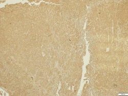 ADAMTS5 Antibody, Novus Biologicals 0.1mL; Unlabeled:Antibodies, Polyclonal