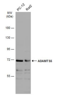 ADAMTS5 Antibody, Novus Biologicals 0.1mL; Unlabeled:Antibodies, Polyclonal