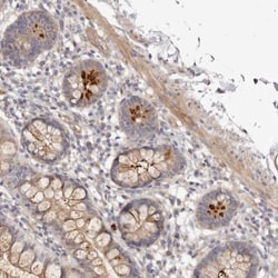 ADAMTS9 Antibody, Novus Biologicals:Antibodies:Primary Antibodies