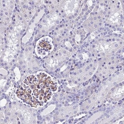 ADAMTSL2 Antibody, Novus Biologicals 0.1mL; Unlabeled:Antibodies, Polyclonal