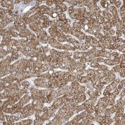 ADAMTSL3 Antibody, Novus Biologicals 25ul | Buy Online | Novus Biologicals | Fisher Scientific