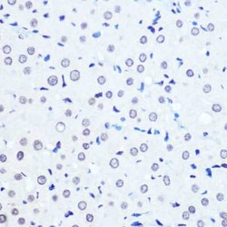 ADAR Rabbit anti-Human, Mouse, Rat, Clone: 7H1U2, Novus Biologicals:Antibodies:Primary