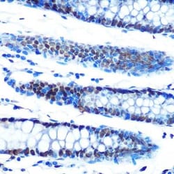 ADAR Rabbit anti-Human, Mouse, Rat, Clone: 7H1U2, Novus Biologicals:Antibodies:Primary