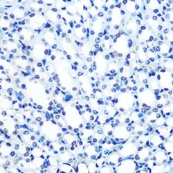 ADAR Rabbit anti-Human, Mouse, Rat, Clone: 7H1U2, Novus Biologicals:Antibodies:Primary
