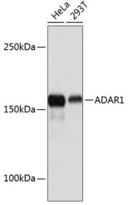 ADAR Rabbit anti-Human, Mouse, Rat, Clone: 7H1U2, Novus Biologicals:Antibodies:Primary