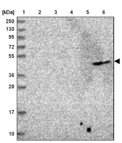 ADAT1 Antibody, Novus Biologicals:Antibodies:Primary Antibodies