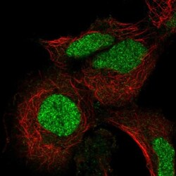 ADAT3 Antibody, Novus Biologicals 25 &mu;L, Unlabeled:Antibodies, Polyclonal