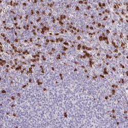 ADCK1 Antibody, Novus Biologicals 25 &mu;L, Unlabeled:Antibodies, Polyclonal