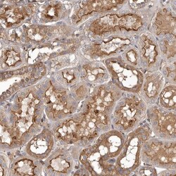 ADCK4 Antibody, Novus Biologicals:Antibodies:Primary Antibodies