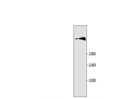 ADCY10 Antibody, Novus Biologicals 100 &mu;g | Buy Online | Novus Biologicals | Fisher Scientific